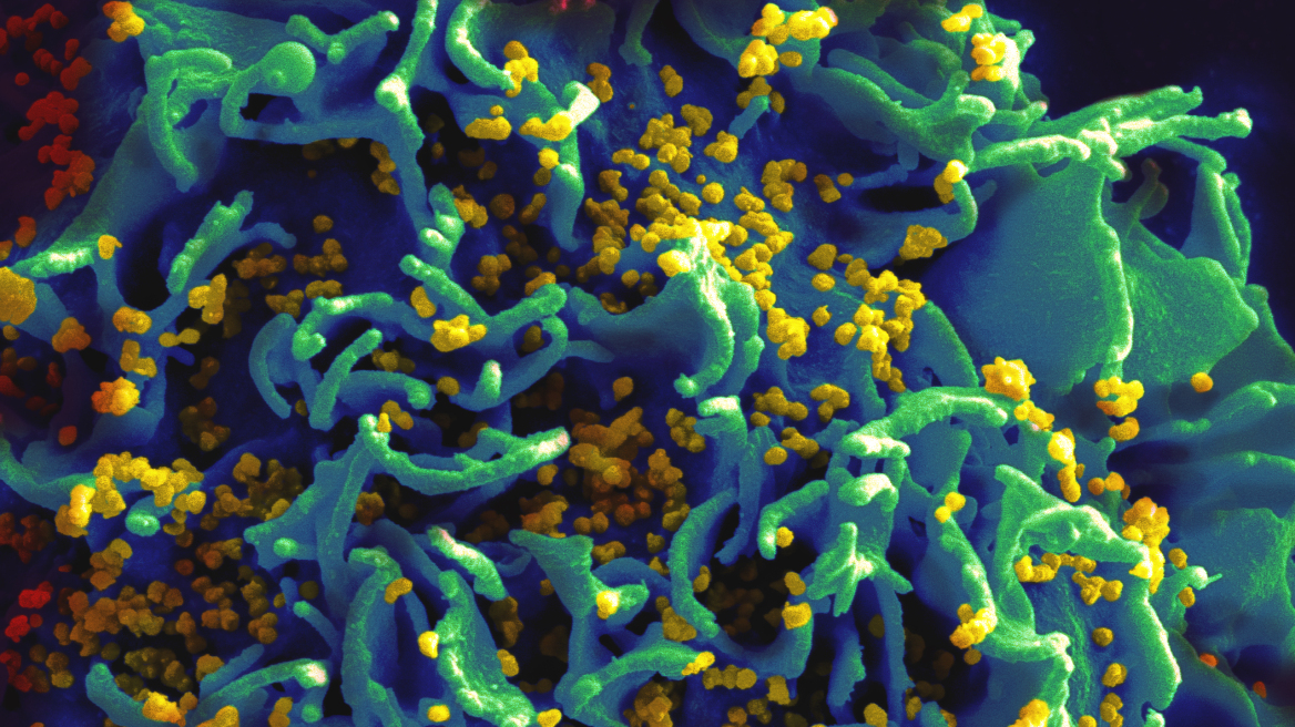 Γαλλία: Δύο φορείς του HIV «αυτο-θεραπεύτηκαν» από τον ιό 