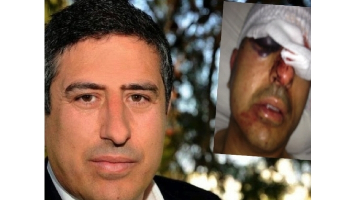 Σοκάρει η φωτογραφία του αντιδημάρχου Ηρακλείου μετά τη δολοφονική επίθεση