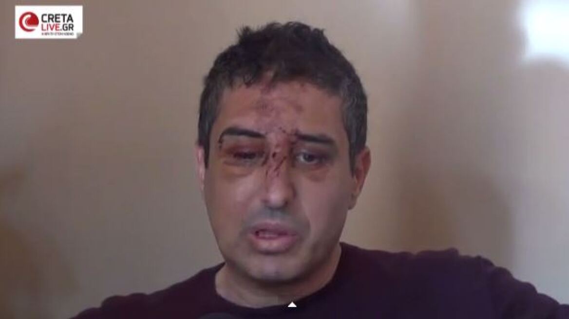 Βίντεο: Ο αντιδήμαρχος Ηρακλείου περιγράφει τη δολοφονική επίθεση που δέχθηκε