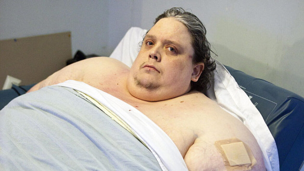Βρετανία: Πέθανε ο πιο παχύσαρκος άνθρωπος στον κόσμο