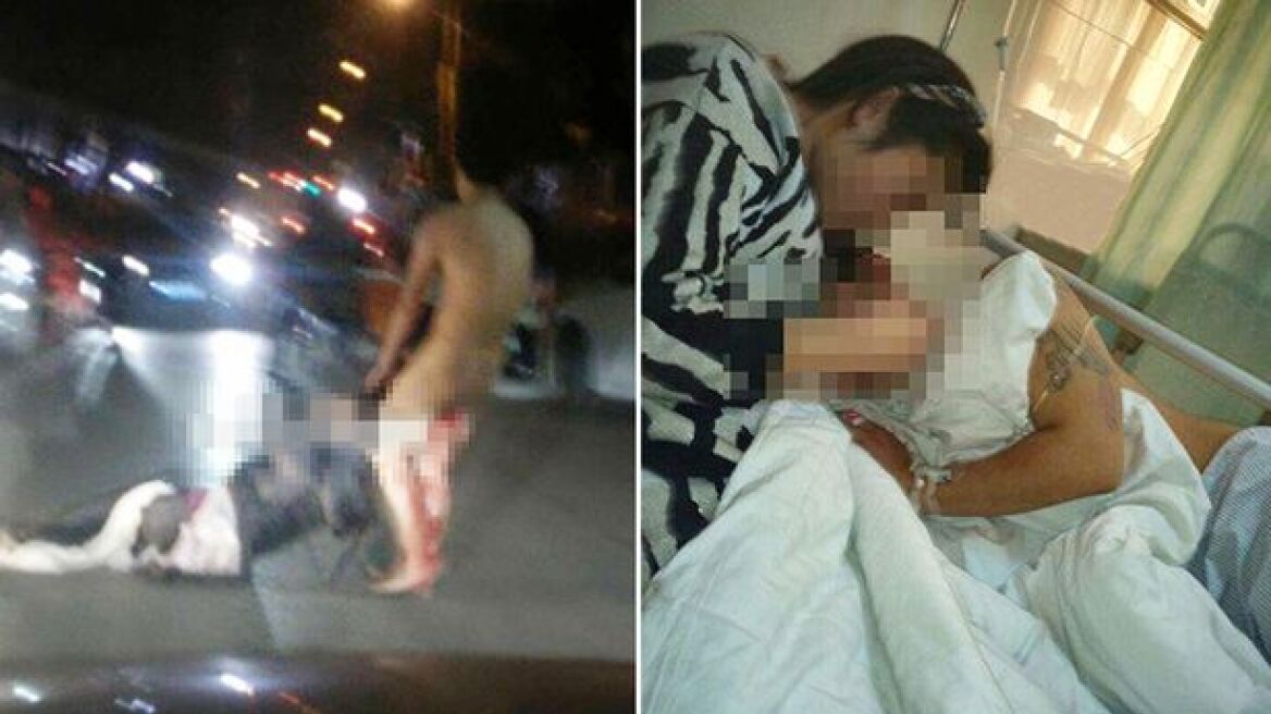 Κίνα: Απατημένη σύζυγος έκοψε δύο φορές το πέος του συζύγου της