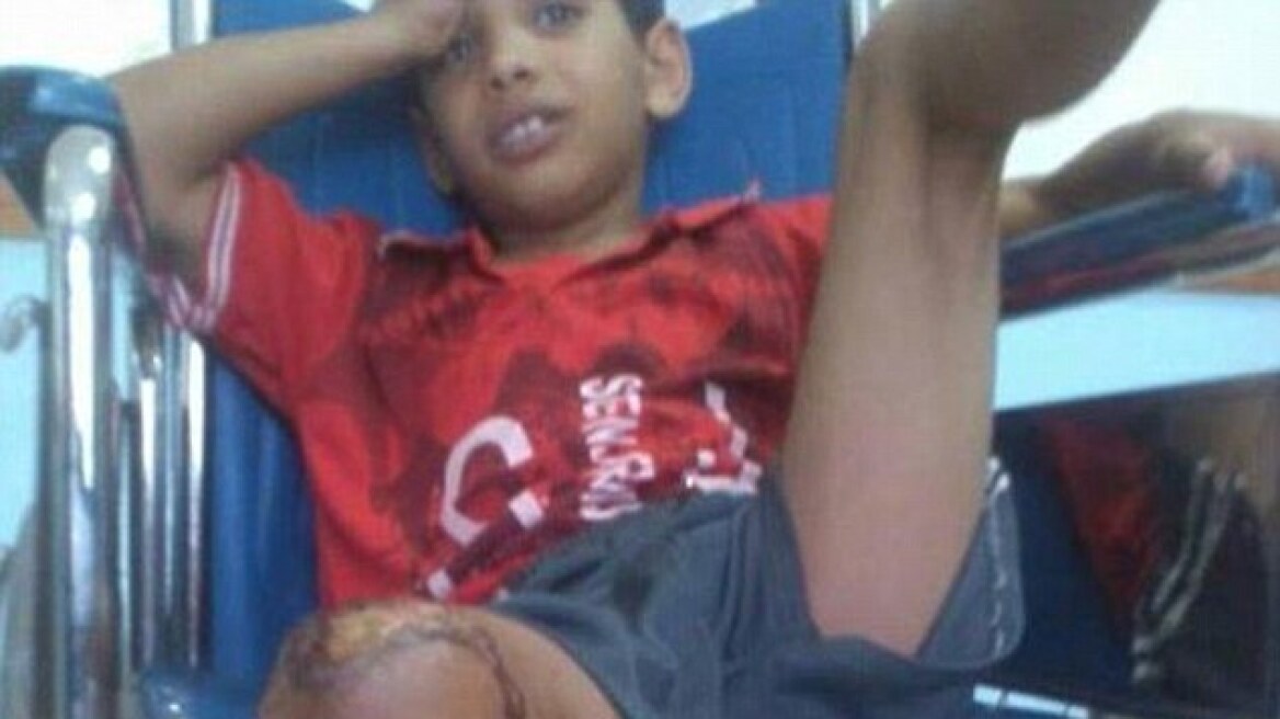 Υεμένη: Παιδιά κλείδωσαν 10χρονο σε κλουβί και του έβαλαν φωτιά!