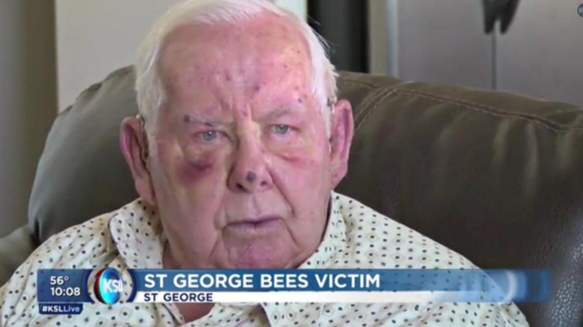 ΗΠΑ: Άνδρας δέχτηκε 400 τσιμπήματα από μέλισσες!