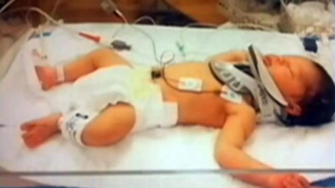 ΗΠΑ: Νοσοκόμα αποκοιμήθηκε και το νεογέννητο της έπεσε από τα χέρια!