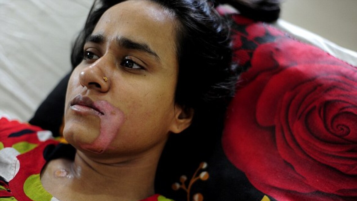 Μπαγκλαντές: Πεθερός έδωσε στην νύφη του να πιει καυστικό οξύ επειδή... ήταν λίγη η προίκα!