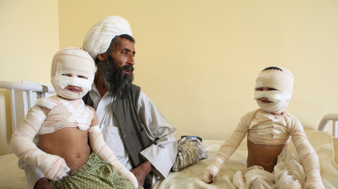 Προσοχή σκληρές εικόνες: Τα εγκλήματα του πολέμου στο Αφγανιστάν