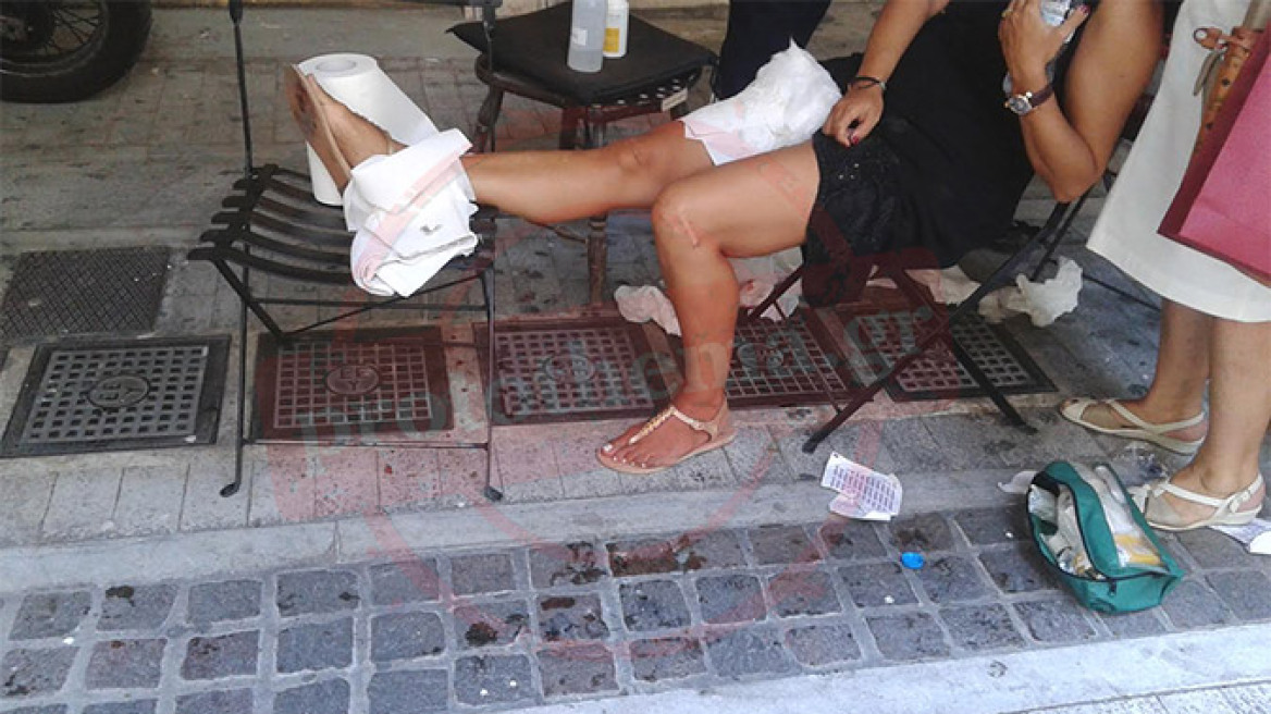 Μηχανισμός τέντας τραυματίζει γυναίκα στο κέντρο της Αθήνας