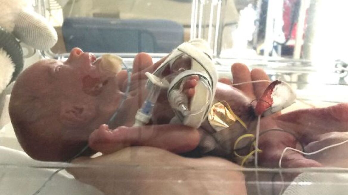 Απίστευτο: Πήρε βιάγκρα και έσωσε το αγέννητο μωρό της 