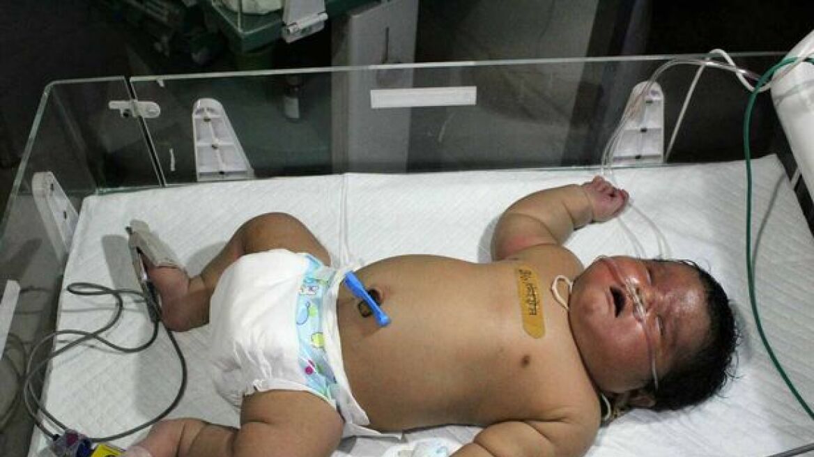 Ινδία: 36χρονη γυναίκα γέννησε με φυσιολογικό τοκετό μωρό 6,5 κιλών