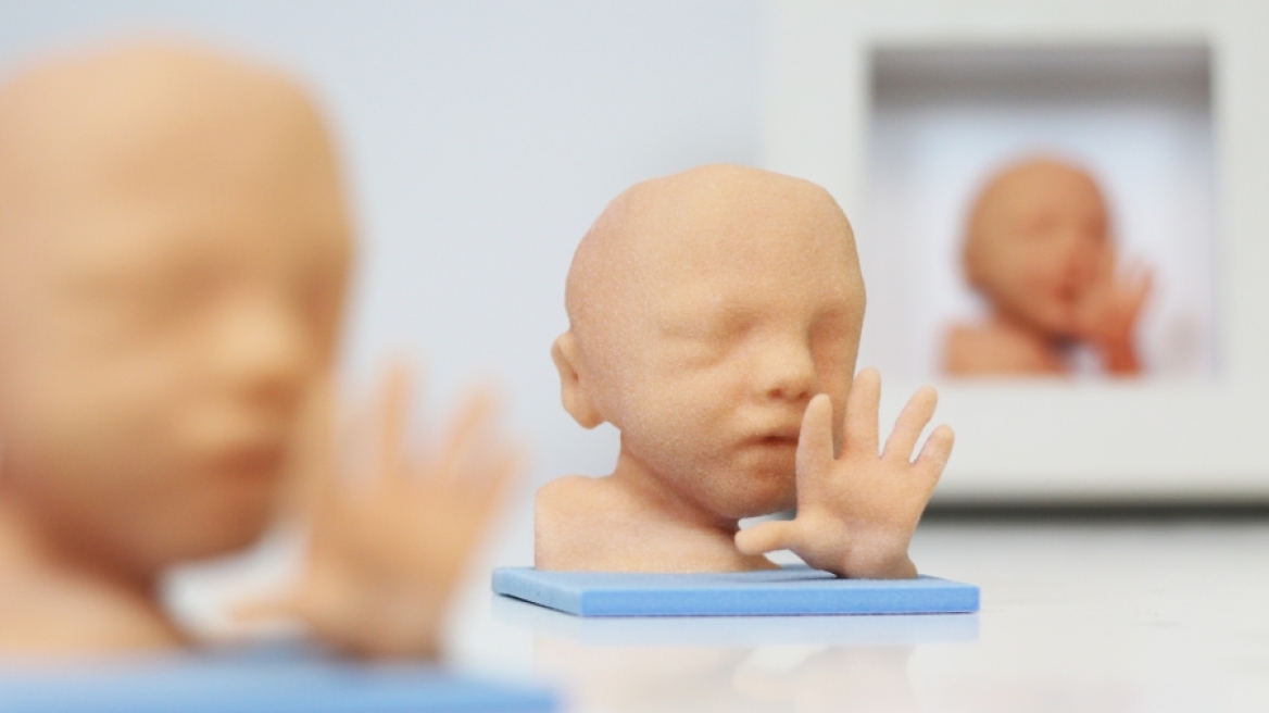 Πώς μπορείτε να εκτυπώσετε 3D το αγέννητο μωρό σας