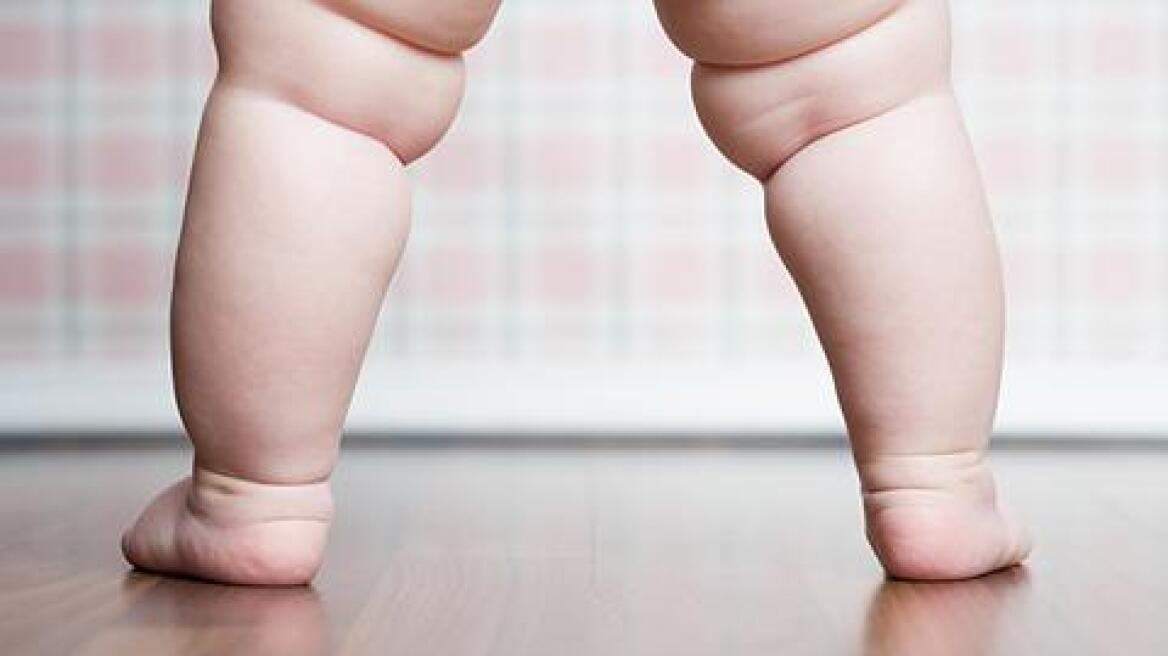 Τα πιο φτωχά παιδιά είναι πιθανότερο να είναι παχύσαρκα 