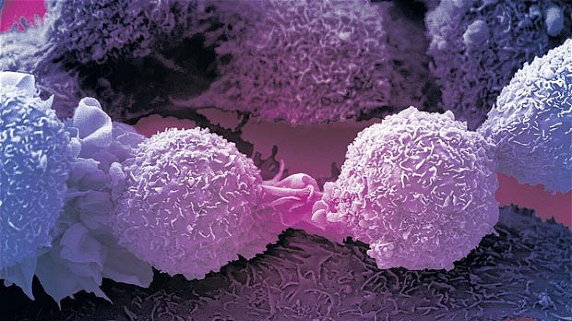 Μεγάλες ελπίδες: Οι επιστήμονες βρήκαν την «αχίλλειο πτέρνα» όλων των καρκίνων