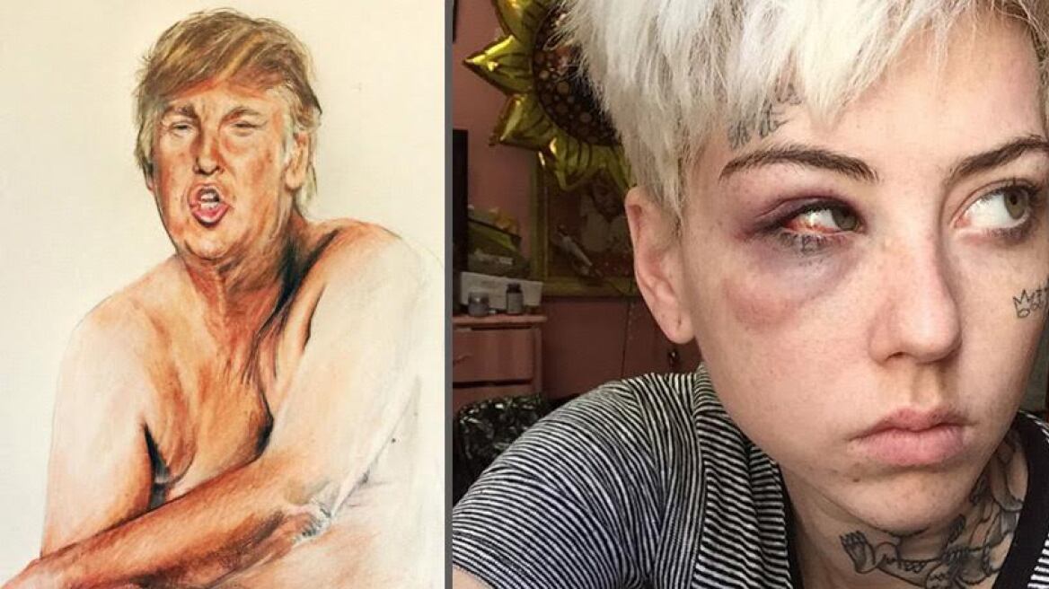 Γρονθοκόπησαν τη γυναίκα που ζωγράφισε τον πίνακα με το… μικροσκοπικό μόριο του Τραμπ