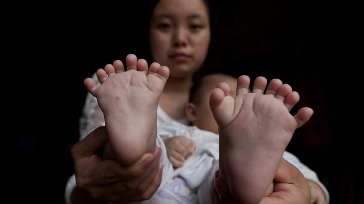Aπίστευτο: Γεννήθηκε μωρό με 15 δάχτυλα στα χέρια και 16 στα πόδια