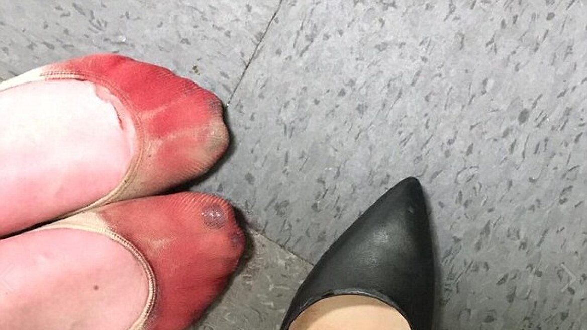 Φωτογραφία: Μάτωσαν τα πόδια σερβιτόρας που την ανάγκασαν να φορά ψηλοτάκουνα