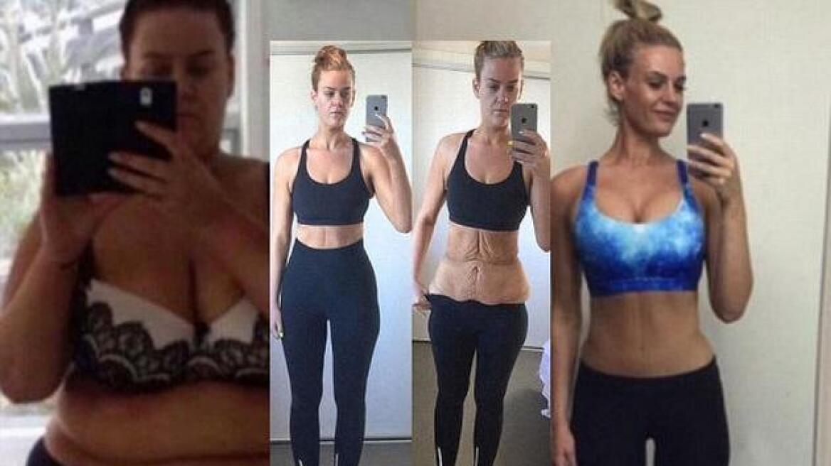 Έχασε 96 ολόκληρα κιλά και «ανέβασε» τη μεταμόρφωσή της στο Instagram 