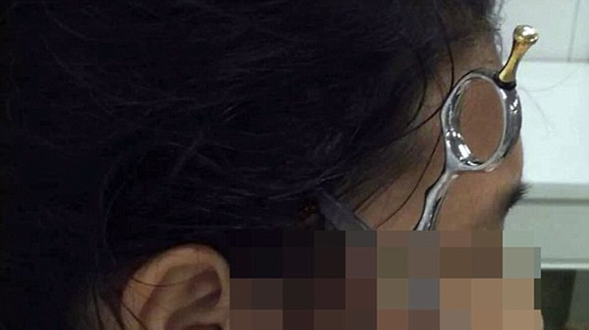 Σοκ: Πατέρας «κάρφωσε» ψαλίδι στο κεφάλι της κόρης του επειδή δεν διάβαζε τα μαθήματά της