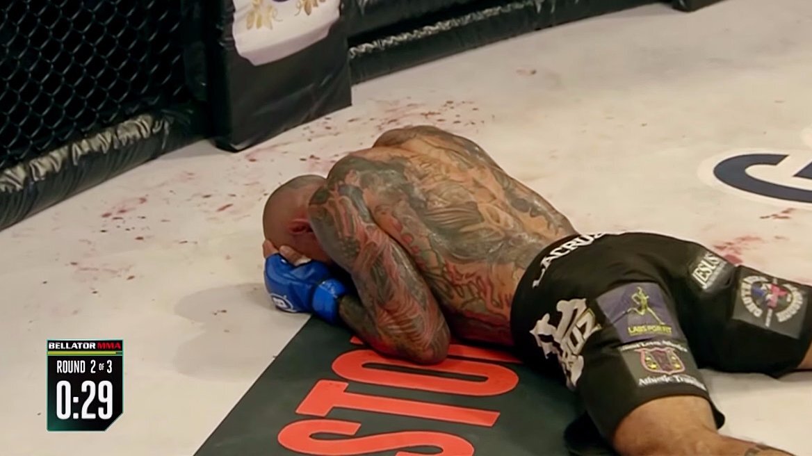 Brutal MMA knock out fractures scull (literally)! (warning: graphic photos!)