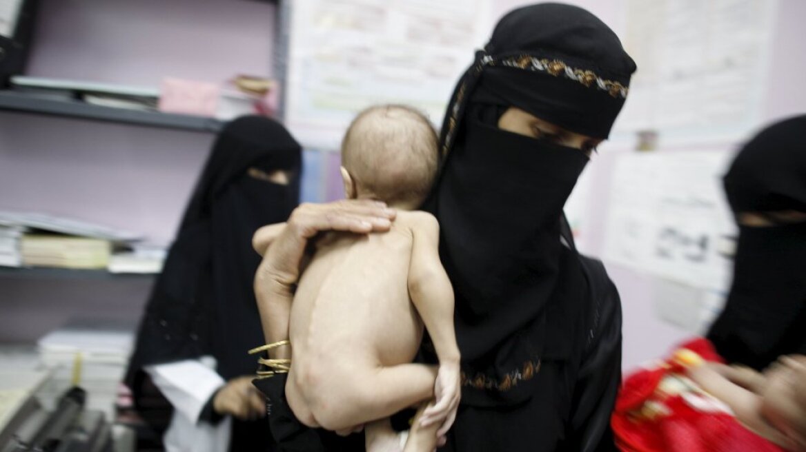 Σοκάρουν οι εικόνες από υποσιτισμένα παιδιά στην Υεμένη