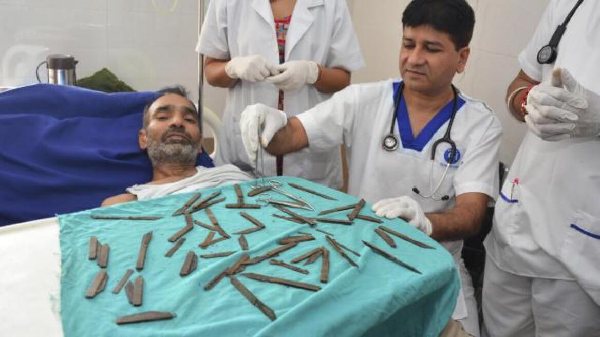 Απίστευτο βίντεο: Γιατροί έβγαλαν 40 μαχαίρια από το στομάχι Ινδού αστυνομικού!