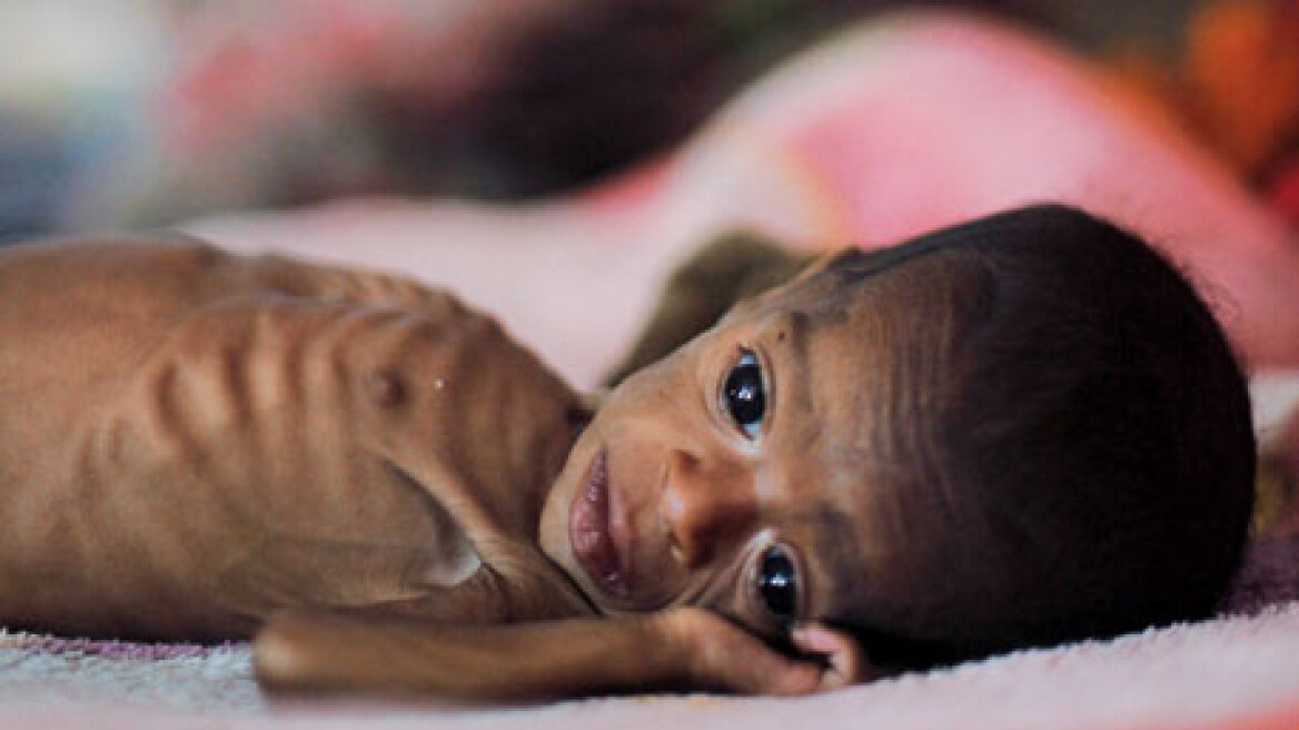 Απίστευτα στοιχεία: Ένα στα τέσσερα παιδιά κάτω των πέντε ετών παγκοσμίως υποσιτίζεται!