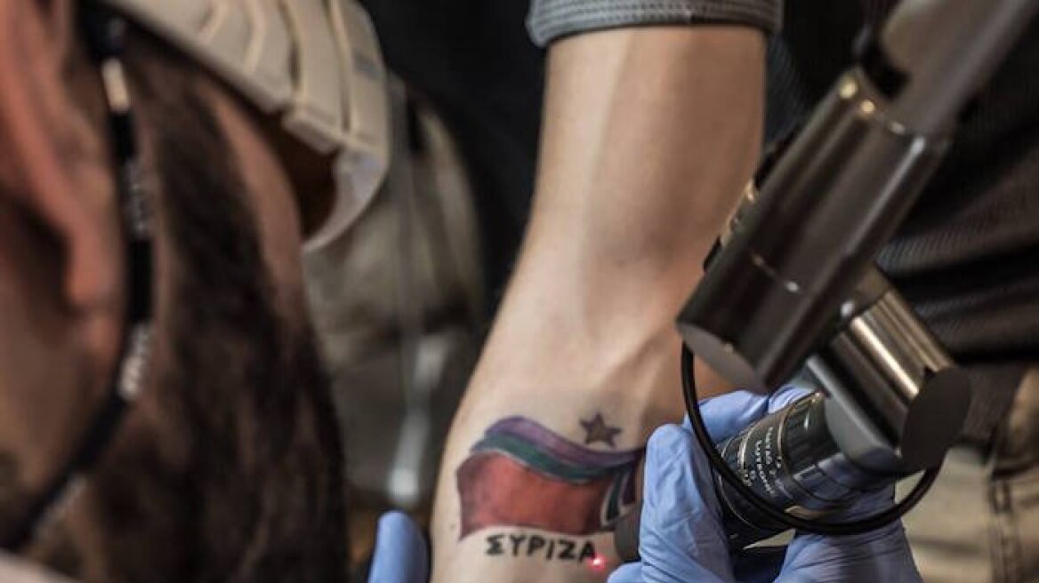 Κάποιος αλήθεια είχε κάνει τατουάζ ΣΥΡΙΖΑ και πήγε να του το σβήσουν (pics)