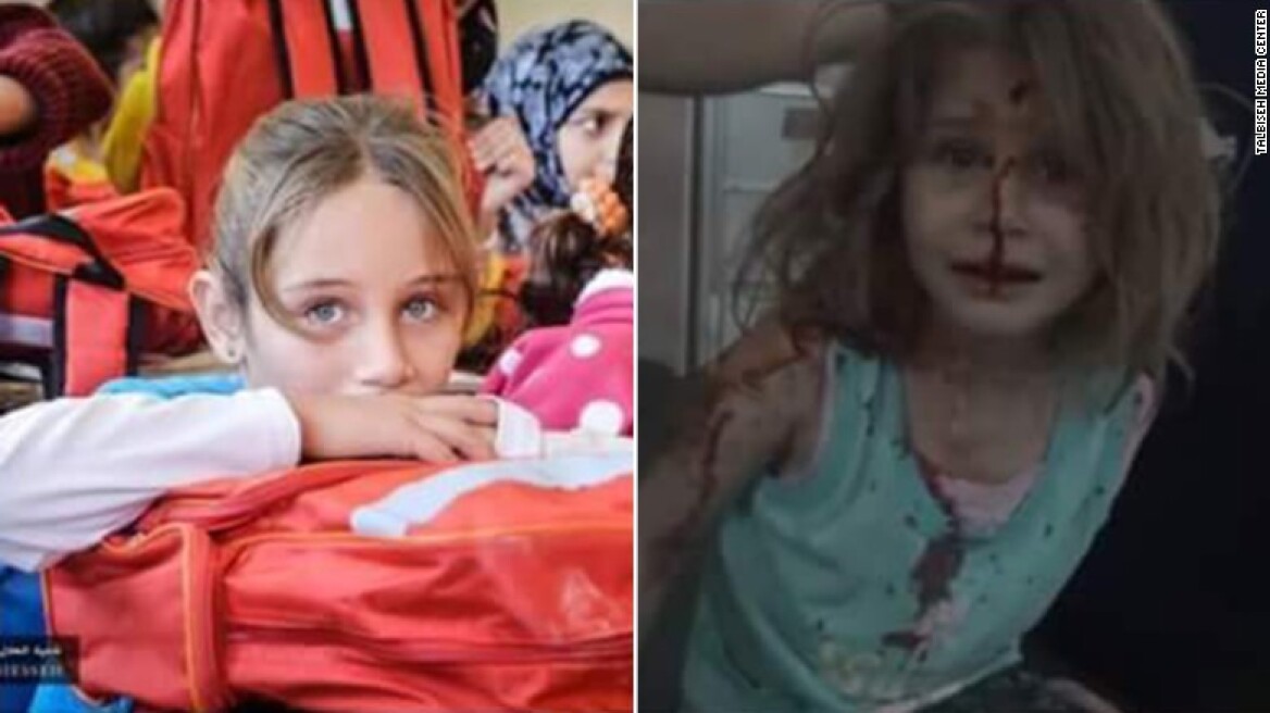 Εικόνες σοκ από τη Συρία: Η μικρή Aya πριν και μετά τον βομβαρδισμό στο σπίτι της