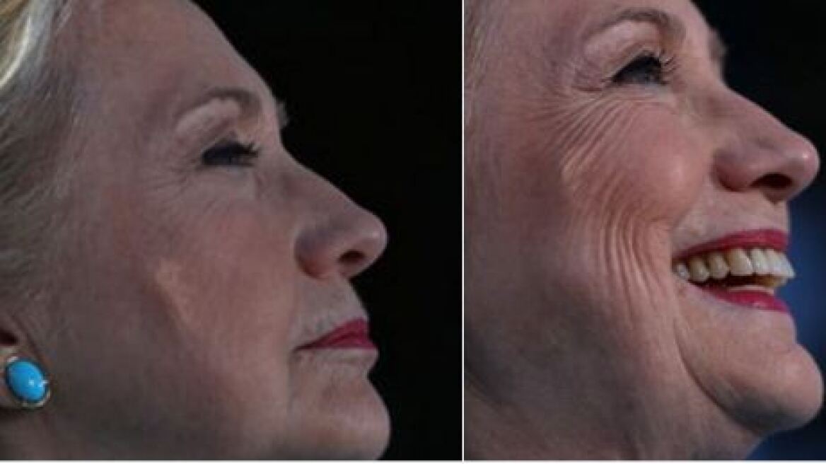 Φωτογραφία σοκ: Τι έχει το μάγουλο της Χίλαρι; 