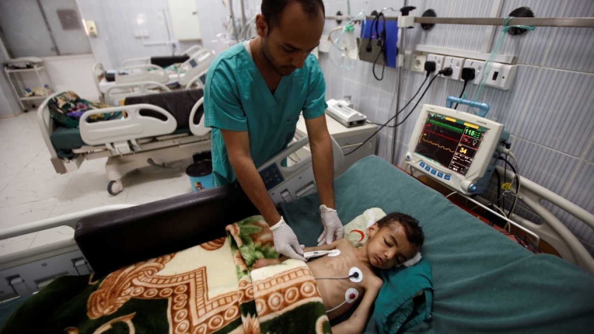 Υεμένη: Ξεπέρασαν τις 4.000 τα ύποπτα κρούσματα χολέρας