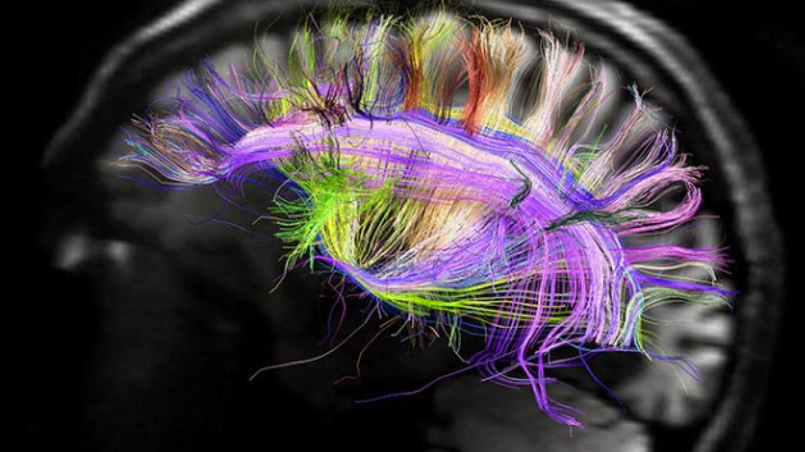 Ανακαλύφθηκαν για πρώτη φορά εγκεφαλικοί νευρώνες που «κρίνουν» πόσος χρόνος πέρασε