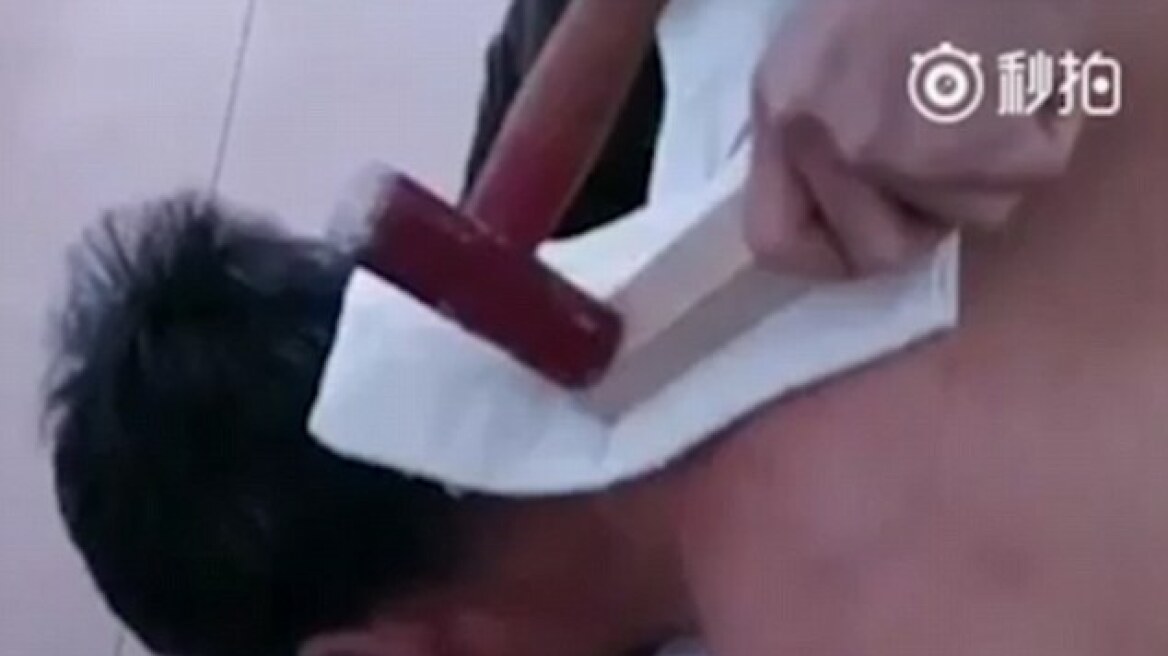 Βίντεο: «Θεραπεύει» το εγκεφαλικό χτυπώντας τον ασθενή στο κεφάλι με... σφυρί