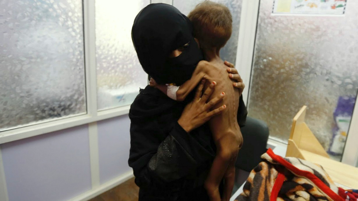 Unicef: Σχεδόν 2,2 εκατομμύρια παιδιά στην Υεμένη υποφέρουν από υποσιτισμό