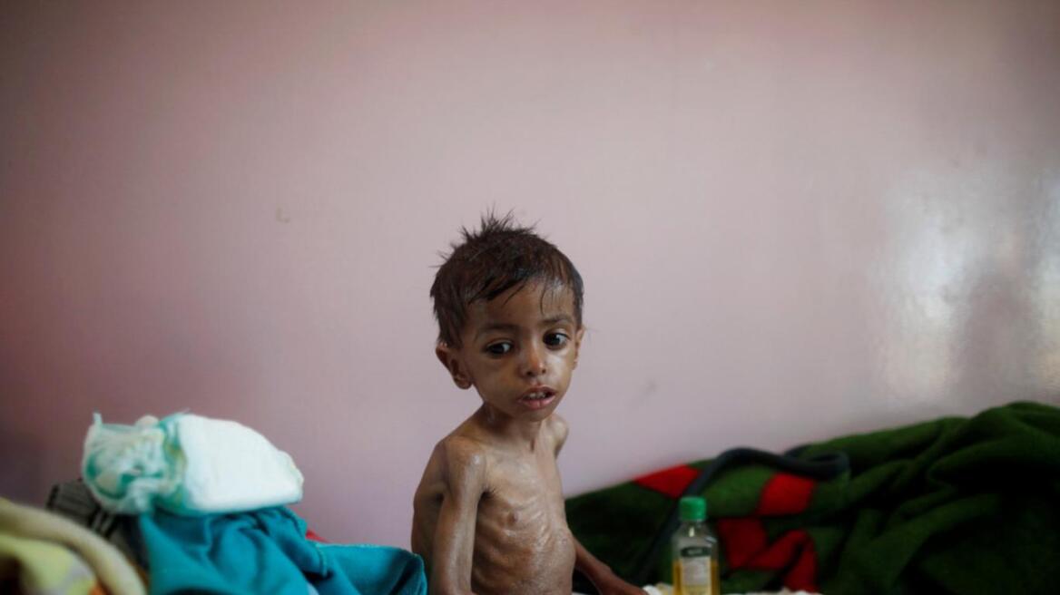 Υεμένη: Απελπισμένοι άνθρωποι ψάχνουν για φαγητό στις χωματερές 