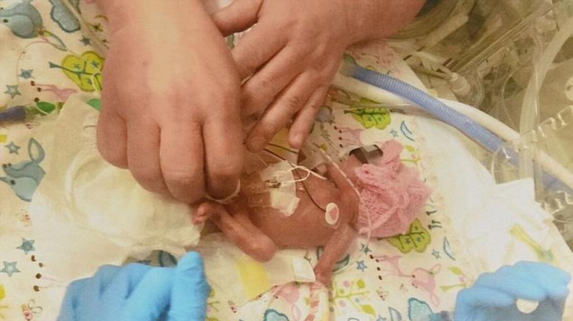 Το θαύμα της ζωής: Μωρό γεννήθηκε 623 γραμμάρια, έκανε 11 λεπτά να αναπνεύσει και επέζησε!
