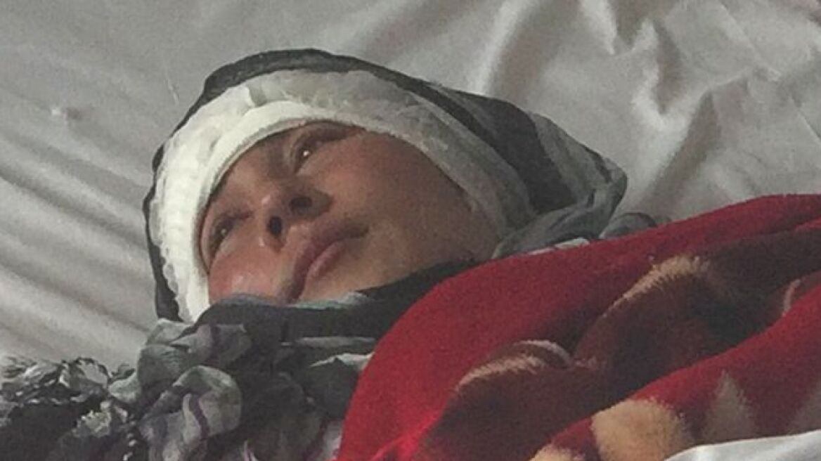 Αφγανός έκοψε τα αυτιά της γυναίκας του