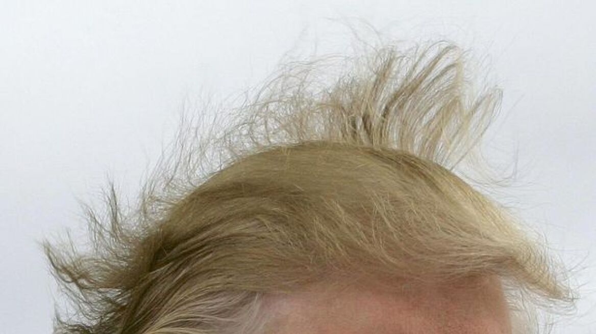 Λύθηκε το «μυστήριο» με τα μαλλιά του Τραμπ: Είναι, με... χαρτί γιατρού, αληθινά!