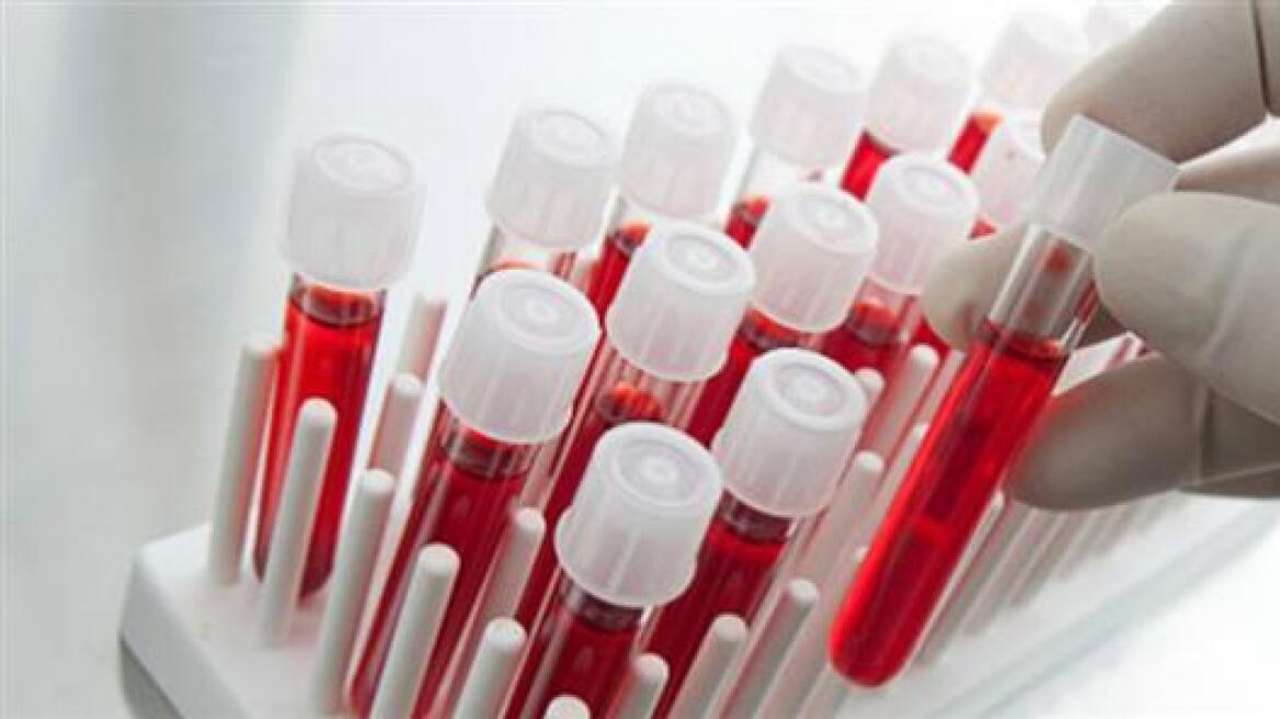 Νέο τεστ αίματος ανιχνεύει όχι μόνο τον καρκίνο, αλλά και πού αναπτύσσεται στο σώμα 