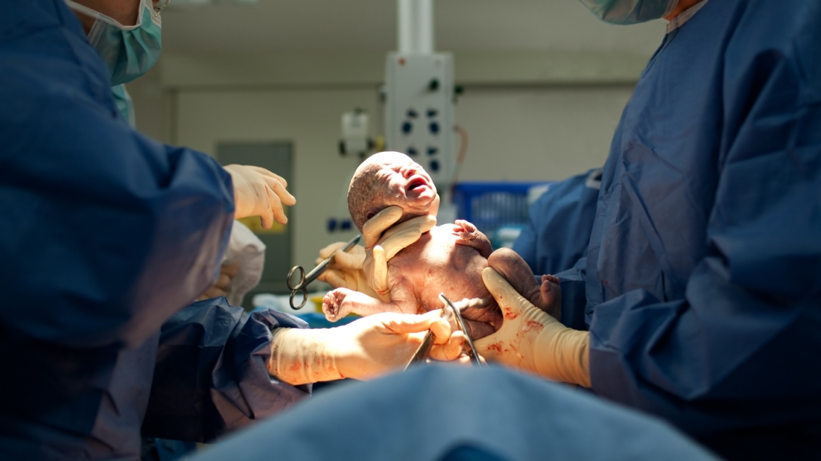 Έρευνα-σοκ: Πάνω από τις μισές Ελληνίδες γεννούν με καισαρική