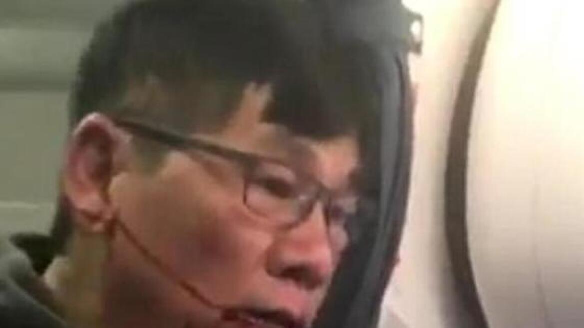 Δεν είναι καλά στην υγεία του ο επιβάτης που «πέταξαν» από την United Airlines