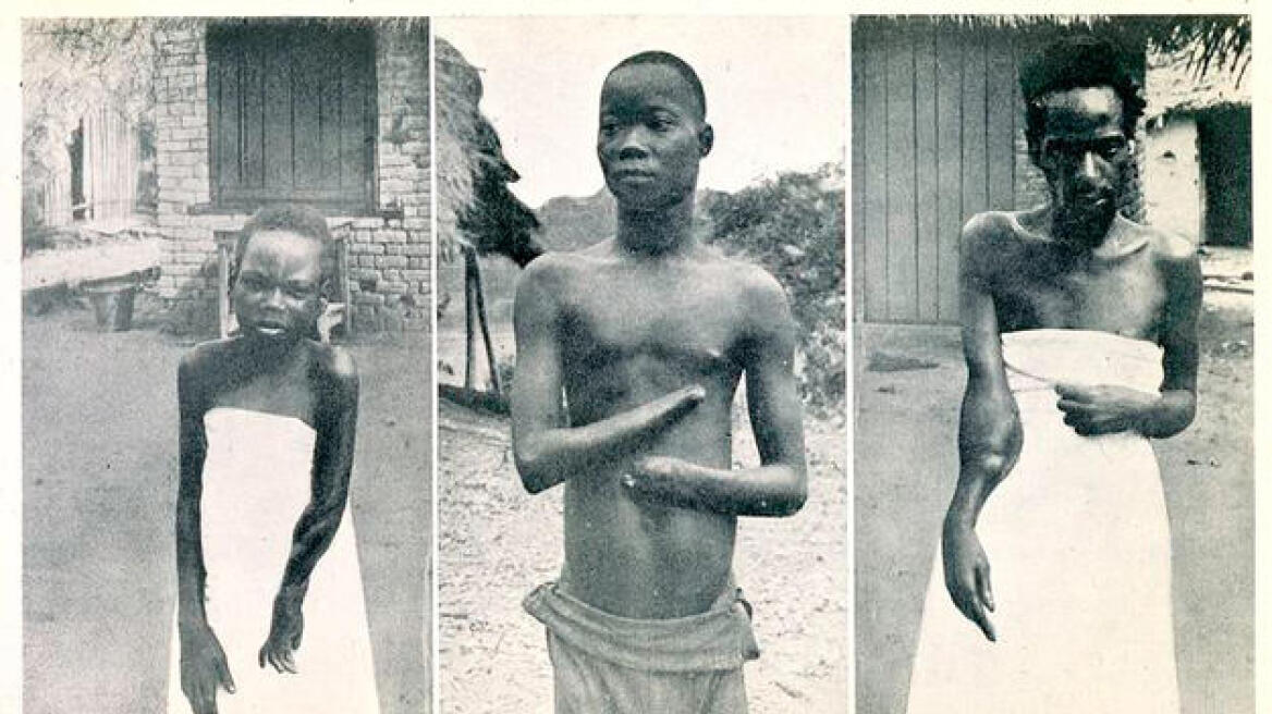 Meet King Leopold II of Belgium: The “Hitler of Congo” (PHOTOS)