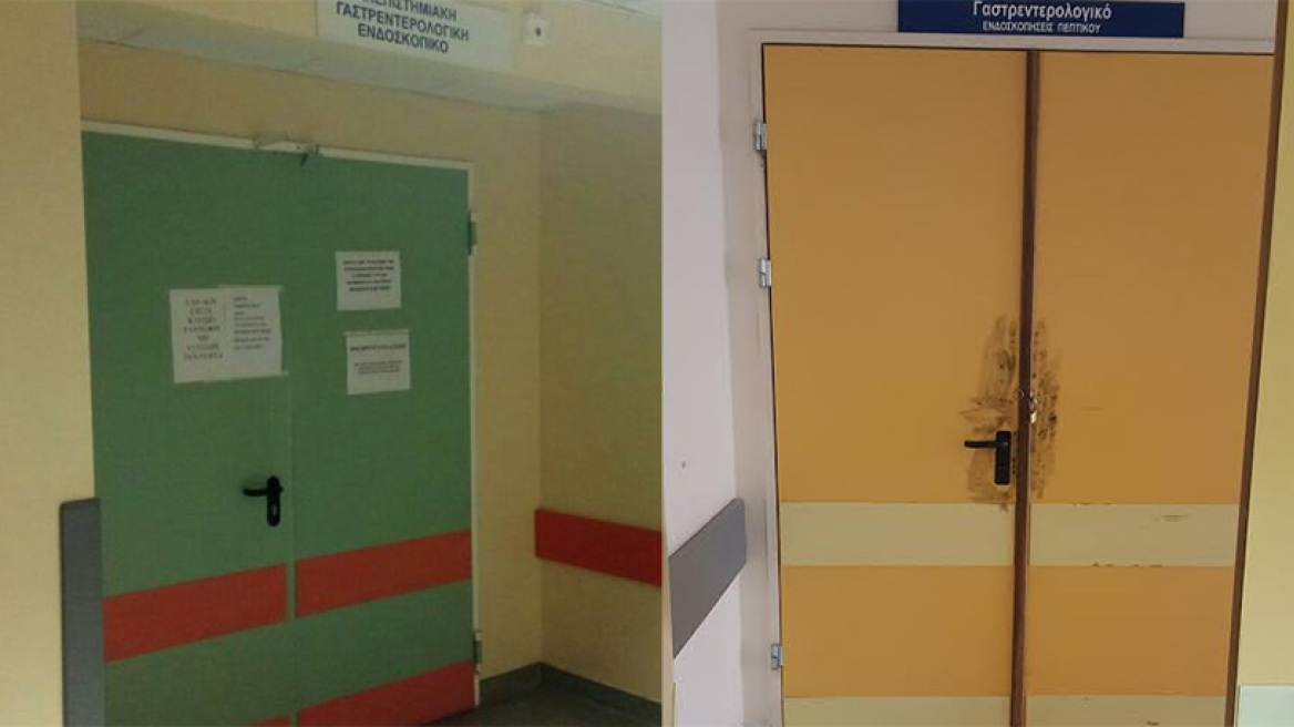 Ξέφραγο αμπέλι τα νοσοκομεία: Έκλεψαν πανάκριβο εξοπλισμό χωρίς κανείς να το αντιληφθεί