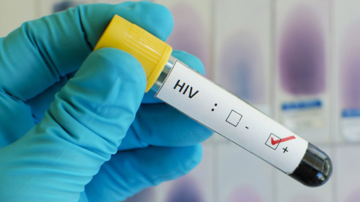 AIDS: Επιστήμονες δημιούργησαν καλύτερο και φθηνότερο τεστ ανίχνευσης του ιού