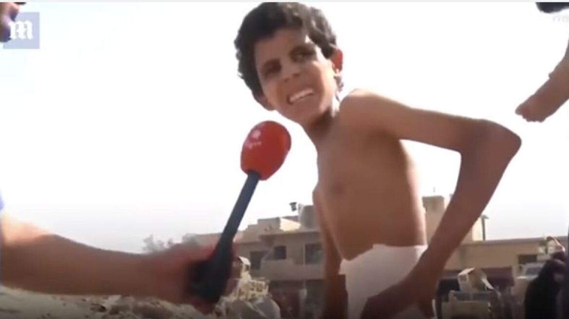 Ιράκ: Συγκλονίζει το σκελετωμένο αγόρι – Κρυβόταν τραυματισμένο επί 20 ημέρες 