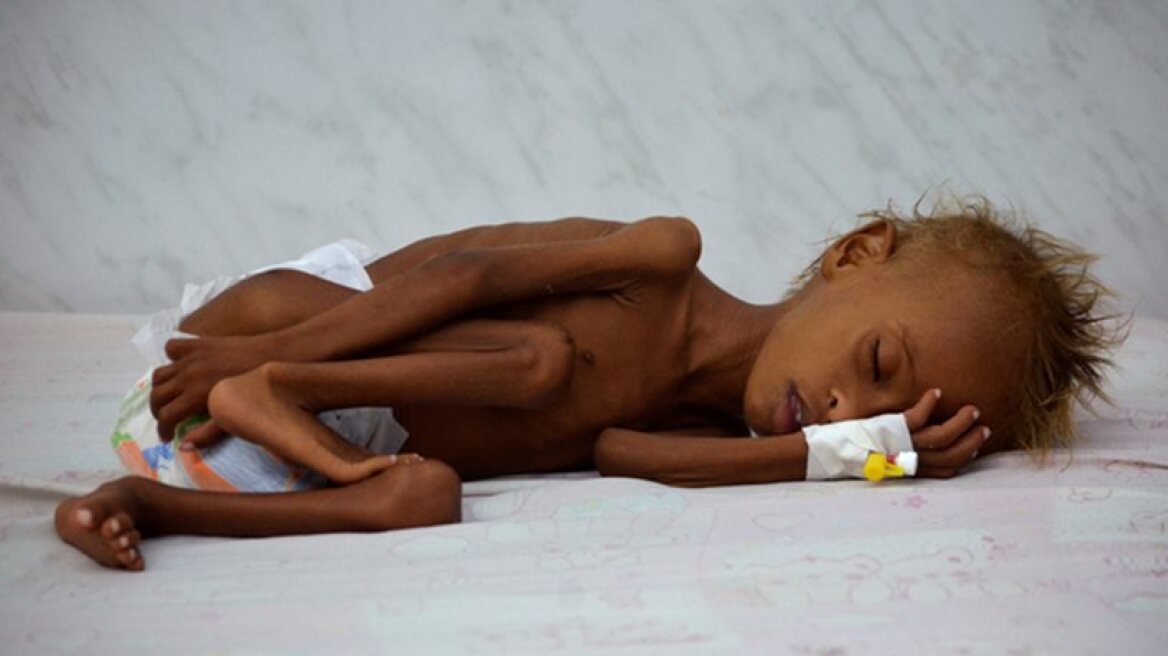 Σε «αργό θάνατο» η Υεμένη: Πάνω από επτά εκατομμύρια άνθρωποι στα όρια του λιμού