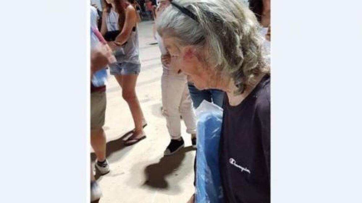 Κύπρος: Χούλιγκανς χτύπησαν ηλικιωμένη φίλαθλο - Δείτε φωτογραφίες 