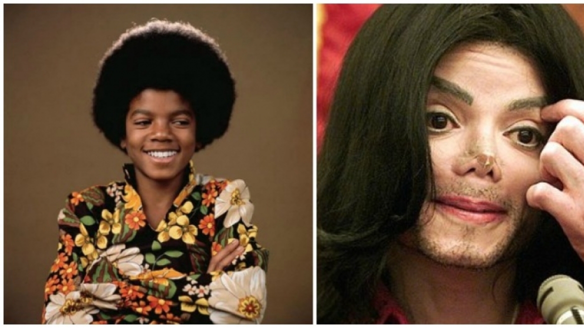 Πώς θα έμοιαζε ο Μάικλ Τζάκσον αν δεν είχε κάνει καμία πλαστική