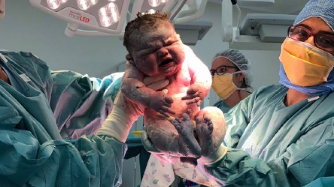 Νεογέννητο 6 κιλών στην Αυστραλία – Είναι αυτό το βαρύτερο μωρό στον κόσμο;