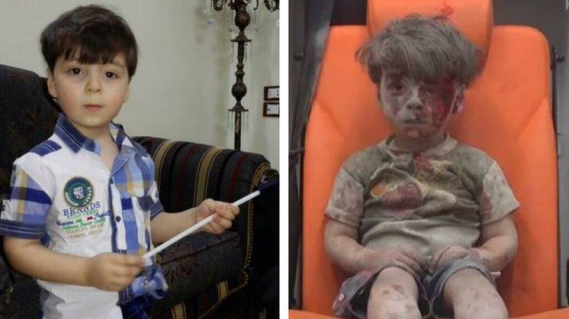 Ομράν: Το παιδί-σύμβολο του συριακού δράματος μιλάει για τη νέα του ζωή 