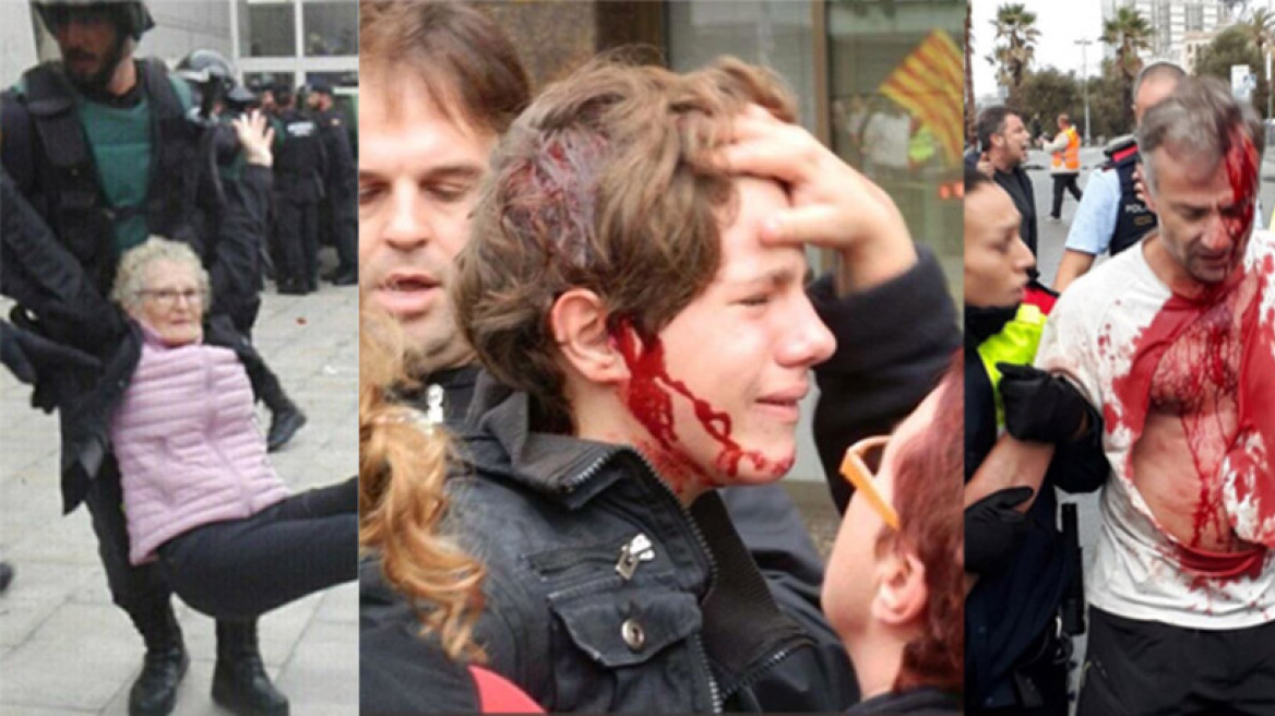 Σοκ στην Καταλονία: Πλαστικές σφαίρες, ξύλο και πάνω από 844 τραυματίες από την επίθεση της αστυνομίας