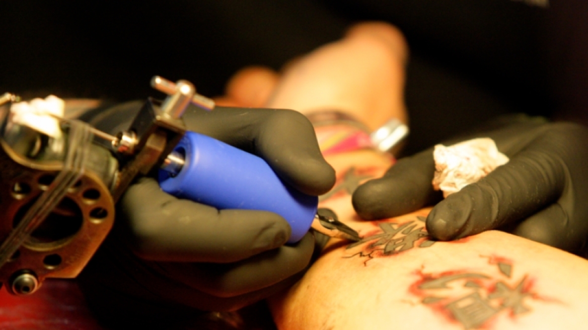 Πώς ένα παλιό τατουάζ προκάλεσε σε μια γυναίκα καρκίνο